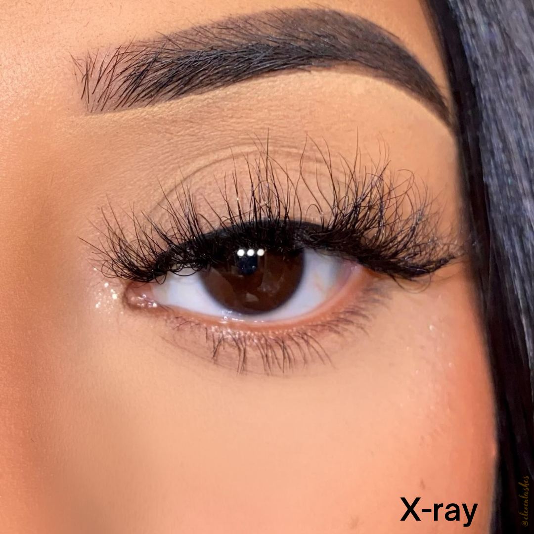 X-Ray